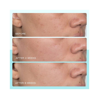 Facial Radiance Niacinamide Dark Spot Serum Travel size