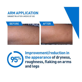 Intensive Moisturizing Lotion 5% Hydro-Urea & Shea Butter