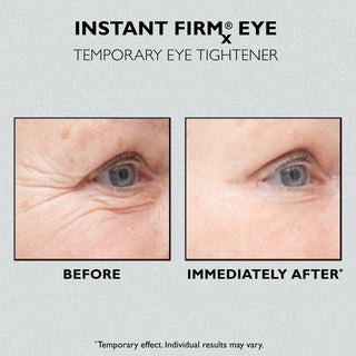 Instant Firmx Eye Temporary Eye Tightener