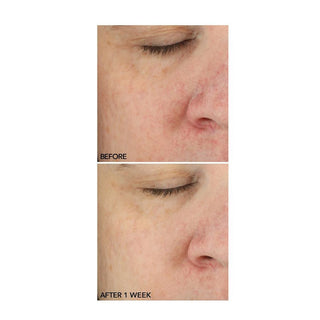 Stress Rescue Super Serum With Niacinamide