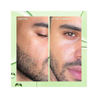 Deep Sweep Pore Cleansing 2% BHA Toner Travel Size