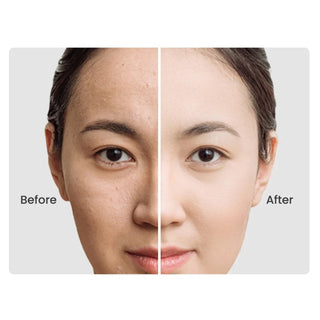BEAUTY RESERVE - TO ALOE 2% + NAG 2% SOLUTIONS