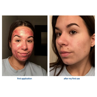 BEAUTY RESERVE - TO AHA 30% + BHA 2% PEELING SOLUTION 15ML