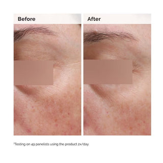 Niacinamide 5% Face and Body Emulsion