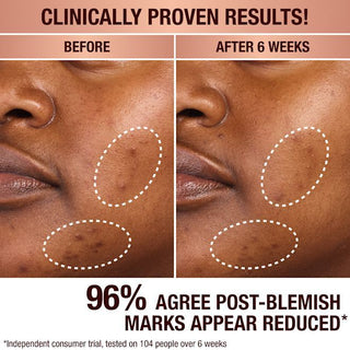 Dark Spot Correcting Radiance Recovery Serum 4.5ml