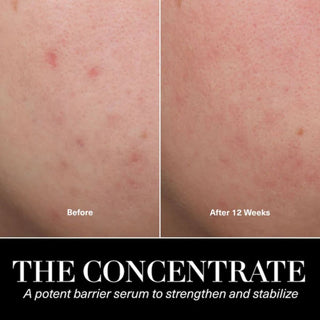 The  Concentrate Travel Size