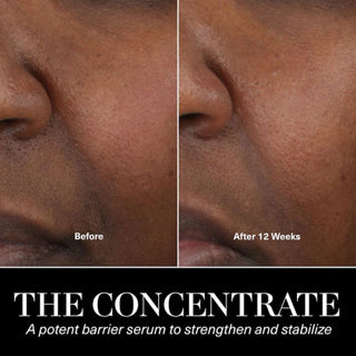 The  Concentrate Travel Size