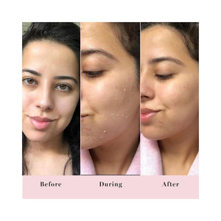 Rub-A-Dub Refining Peel Gel 10ml Travel Size