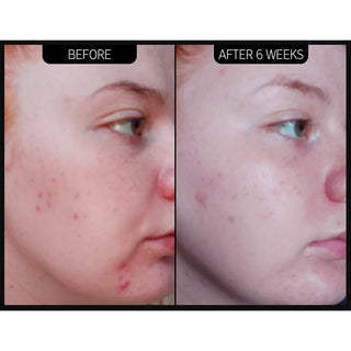 Scar, Mark and Wrinkle Solution