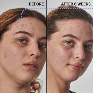 Dry and Rough Skin Solution
