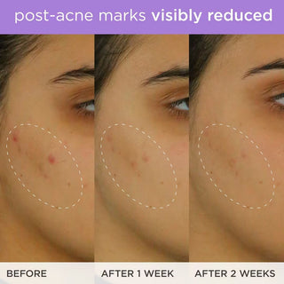 The Brightening Serum